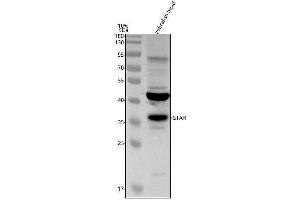 Western blot analysis of STAR using anti-STAR antibody (AZQ9DG10).