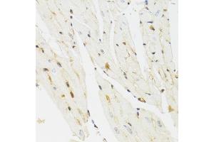 Immunohistochemistry of paraffin-embedded mouse heart using THAP1 antibody (ABIN5975558) at dilution of 1/100 (40x lens).