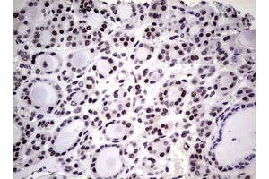 Image no. 12 for anti-Nibrin (NBN) (AA 183-460) antibody (ABIN1491066)