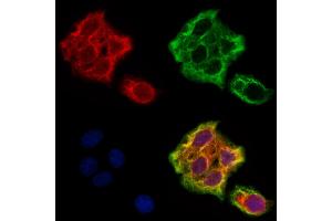 ABIN6265622 and ABIN6273178 staining Hela cells by IF/ICC. (TMSB4X anticorps  (N-Term))