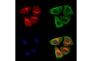 ABIN7094684 and ABIN7098735 staining Hela cells by IF/ICC. (BSCL2 anticorps  (Internal Region))