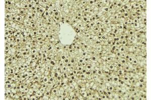 ABIN6273298 at 1/100 staining Mouse liver tissue by IHC-P. (PIP5K1A anticorps  (N-Term))
