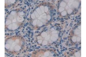 Used in DAB staining on fromalin fixed paraffin- embedded Kidney tissue