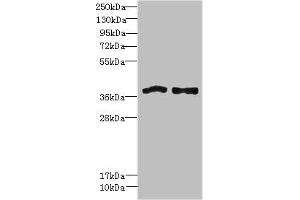 Western blot All lanes: FPR1 antibody at 6 μg/mL Lane 1: Colo320 whole cell lysate Lane 2: HT29 whole cell lysate Secondary Goat polyclonal to rabbit IgG at 1/10000 dilution Predicted band size: 39 kDa Observed band size: 39 kDa (FPR1 anticorps  (AA 306-350))