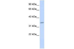 WB Suggested Anti-CDK5 Antibody Titration:  0. (CDK5 anticorps  (N-Term))
