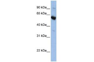 WB Suggested Anti-SLC45A3 Antibody Titration:  0. (SLC45A3 anticorps  (Middle Region))