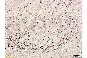 Formalin-fixed and paraffin embedded rat brain labeled with Rabbit Anti-CDK5 Polyclonal Antibody (ABIN670101) at 1:200 followed by conjugation to the secondary antibody and DAB staining. (CDK5 anticorps  (AA 15-100))