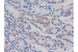 Detection of IL11Ra in Mouse Small intestine Tissue using Polyclonal Antibody to Interleukin 11 Receptor Alpha (IL11Ra) (IL11RA anticorps  (AA 194-329))