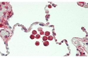 Detection of CHI3L1 in Human Lung Tissue using Polyclonal Antibody to Chitinase-3-like Protein 1 (CHI3L1) (CHI3L1 anticorps  (AA 112-377))