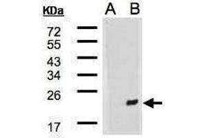 WB Image Western Blot analysis of DNAJB9 expression in transfected 293T cell line by DNAJB9 polyclonal antibody. (DNAJB9 anticorps  (C-Term))