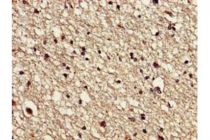 Immunohistochemistry of paraffin-embedded human brain tissue using ABIN7175666 at dilution of 1:100 (VPS16 anticorps  (AA 7-89))