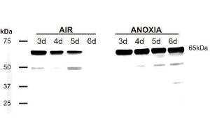 Western Blotting (WB) image for anti-Phosducin (PDC) antibody (ABIN619539) (Phosducin anticorps)