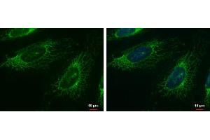 ICC/IF Image FAST antibody detects FAST protein at mitochondria by immunofluorescent analysis.