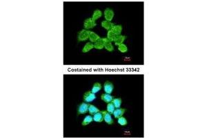ICC/IF Image Immunofluorescence analysis of methanol-fixed A431, using LARS2, antibody at 1:200 dilution. (LARS2 anticorps)