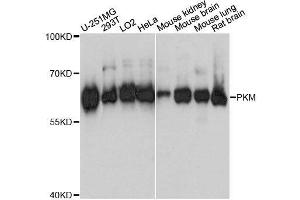 Western blot analysis of extracts of various cell lines, using PKM antibody. (PKM anticorps  (AA 11-221))