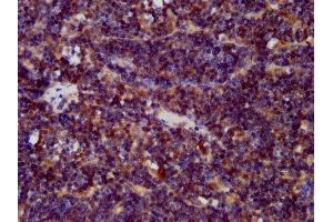 IHC image of ABIN7147311 diluted at 1:400 and staining in paraffin-embedded human lymph node tissue performed on a Leica BondTM system.