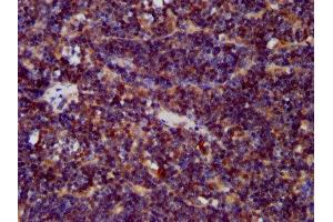 IHC image of ABIN7147311 diluted at 1:400 and staining in paraffin-embedded human lymph node tissue performed on a Leica BondTM system. (CDCA7L anticorps  (AA 14-167))