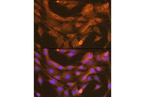 Immunofluorescence analysis of C6 cells using PDI Rabbit mAb (ABIN7269615) at dilution of 1:100 (40x lens). (PDIA6 anticorps)