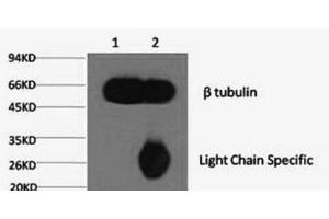 1) Input: Mouse brain tissue, 2) IP product: IP at dilution of 1: 200 (TUBB anticorps)