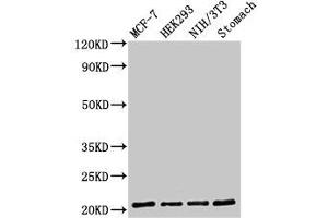 Western Blot Positive WB detected in: MCF-7 whole cell lysate, HEK293 whole cell lysate, NIH/3T3 whole cell lysate, Rat stomach tissue All lanes: CD3G antibody at 2 μg/mL Secondary Goat polyclonal to rabbit IgG at 1/50000 dilution Predicted band size: 21 kDa Observed band size: 21 kDa (CD3G anticorps  (AA 138-182))