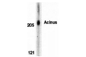 Western Blotting (WB) image for anti-Apoptotic Chromatin Condensation Inducer 1 (ACIN1) (C-Term) antibody (ABIN1030217) (ACIN1 anticorps  (C-Term))