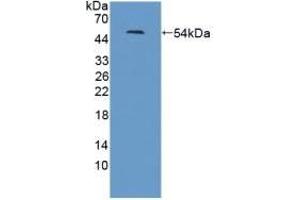 LRRN1 anticorps  (AA 418-631)