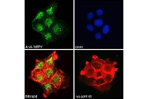 ABIN185451 Immunofluorescence analysis of paraformaldehyde fixed A431 cells, permeabilized with 0.