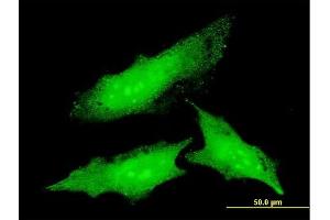 Immunofluorescence of monoclonal antibody to ODC1 on HeLa cell.