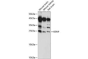 Western blot analysis of extracts of various cell lines, using GDNF antibody (ABIN7267388) at 1:1000 dilution. (GDNF anticorps  (AA 109-211))