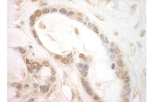 Immunohistochemistry (IHC) image for anti-Eukaryotic Translation Initiation Factor 2B, Subunit 5 Epsilon, 82kDa (EIF2B5) (AA 400-450) antibody (ABIN7454838)