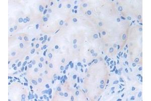 anti-CUB Domain Containing Protein 1 (CDCP1) (AA 689-836) antibody