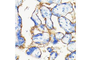 Immunohistochemistry of paraffin-embedded human placenta using [KO Validated] PD-L1/CD274 Rabbit mAb (ABIN7266178) at dilution of 1:100 (40x lens). (PD-L1 anticorps)