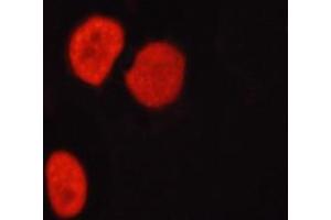 ABIN6267694 staining HepG2 cells by ICC/IF.