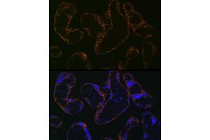 Immunofluorescence analysis of human placenta cells using CYP26 Rabbit mAb (ABIN7266654) at dilution of 1:100 (40x lens).