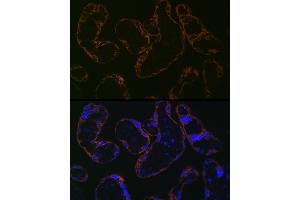 Immunofluorescence analysis of human placenta cells using CYP26 Rabbit mAb (ABIN7266654) at dilution of 1:100 (40x lens). (CYP26A1 anticorps)
