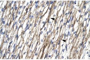 Rabbit Anti-RBM10 Antibody  Paraffin Embedded Tissue: Human Heart Cellular Data: Myocardial cells Antibody Concentration: 4. (RBM10 anticorps  (N-Term))