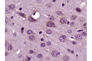 Paraformaldehyde-fixed, paraffin embedded mouse brain, Antigen retrieval by boiling in sodium citrate buffer (pH6) for 15min, Block endogenous peroxidase by 3% hydrogen peroxide for 30 minutes, Blocking buffer (normal goat serum) at 37°C for 20min, Antibody incubation with RNF128 Polyclonal Antibody (bs-9251R) at 1:400 overnight at 4°C, followed by a conjugated secondary and DAB staining.