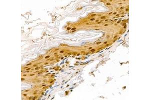 Immunohistochemistry of paraffin embedded mouse stomach using Transketolase (ABIN7075978) at dilution of 1: 2200 (400x lens)