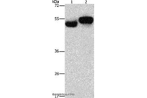 Western blot analysis of Human fetal brain and liver tissue, using AMZ1 Polyclonal Antibody at dilution of 1:1000 (AMZ1 anticorps)