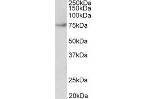 Western Blotting (WB) image for anti-Far Upstream Element (FUSE) Binding Protein 1 (FUBP1) (AA 160-174) antibody (ABIN5900708) (FUBP1 anticorps  (AA 160-174))
