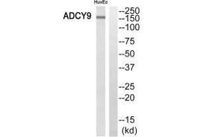 Western blot analysis of extracts from HuvEc cells, using ADCY9 antibody. (ADCY9 anticorps  (N-Term))