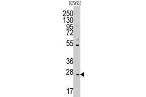 Western blot analysis of CD8B polyclonal antibody  in K-562 cell line lysates (35 ug/lane). (CD8B anticorps  (N-Term))