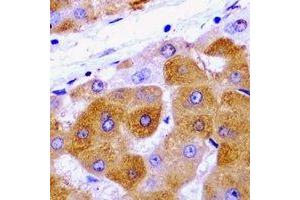 Immunohistochemical analysis of METTL7A staining in rat liver  formalin fixed paraffin embedded tissue section. (METTL7A anticorps)