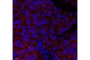 Immunofluorescence of paraffin embedded rat pancreas using Aldh4a1 (ABIN7073000) at dilution of 1: 400 (400x lens)