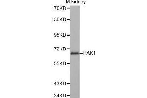 Western Blotting (WB) image for anti-P21-Activated Kinase 1 (PAK1) (AA 1-240) antibody (ABIN6219653) (PAK1 anticorps  (AA 1-240))