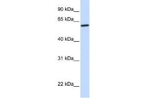 WB Suggested Anti-CYP27A1 Antibody Titration: 0. (CYP27A1 anticorps  (Middle Region))
