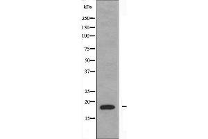 Western blot analysis of extracts from Jurkat cells using NBL1 antibody.