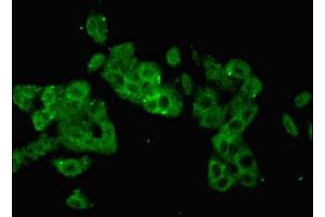 Immunofluorescent analysis of HepG2 cells using ABIN7157384 at dilution of 1:100 and Alexa Fluor 488-congugated AffiniPure Goat Anti-Rabbit IgG(H+L)