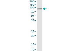 Immunoprecipitation of HAL transfected lysate using anti-HAL monoclonal antibody and Protein A Magnetic Bead , and immunoblotted with HAL MaxPab rabbit polyclonal antibody.