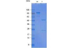 SDS-PAGE gel: 2. (Recombinant SSEA-4 anticorps)